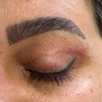 بلفاروپلاستی و ساکشن غبغب آفر ویژه|خدمات آرایشگری و زیبایی|فولادشهر, B4|دیوار