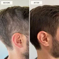 پذیرش مدل اسکالپ سر به صورت رایگان|خدمات آرایشگری و زیبایی|تهران, دروس|دیوار