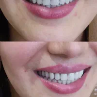 انجام خدمات دندان مصنوعی با شرایط اقساطی