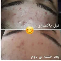 فشیال وپاکسازی تخصصی