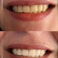 لبخندتو روشن کن یک جلسه یه تغییر بزرک  شرایط ویژه