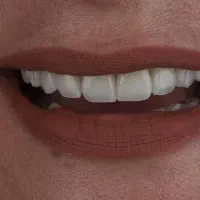 دندانپزشکی و ایمپلنت و لمینت اقساط