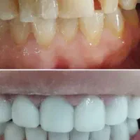 دندانپزشکی اقساط با چک صیادی بدون سود