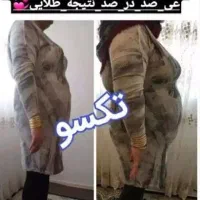 مثل کره چربی سوزی کن
