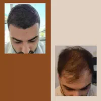 مو عامل زیبایی