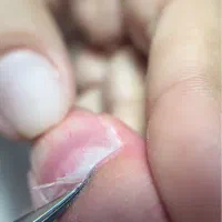 آموزش صفرتاصد کاشت و ترمیم سرعتی سالنی فقط ۱۸۰۰|خدمات آموزشی|گرگان, |دیوار