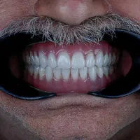 دندانپزشکی ایمپلنت+لمینت+کامپوزیت+ارتودنسی اقساط|خدمات آرایشگری و زیبایی|مشهد, سجاد شهر|دیوار