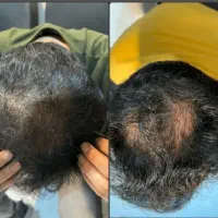 نمایندگی اصلی تونیک ضد ریزش هیرفرند
