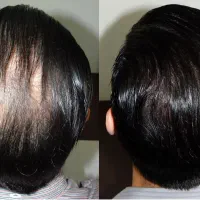 دیگه چیزی از موهات نمونده تا بدتر نشد پیام بده
