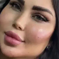 ژل فیلر ومزوتراپی پیرسینگ آفر ۵۰درصد