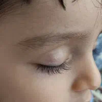 پرستار کودک
