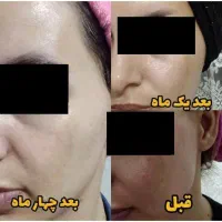 کرم VIP اماراتی معجزه صد درصد تضمینی|آرایشی، بهداشتی، درمانی|شیراز, مسلم|دیوار