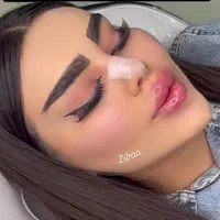 ژل و بوتاکس