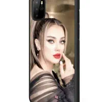 چسباندن عکس های درخواستی روی گارد گوشی