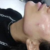 جشنواره فیلر بادی بدن باسن ممنوعه دست پا سی سی۱۸۰|خدمات آرایشگری و زیبایی|شیراز, شریفآباد|دیوار