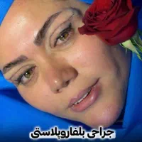 کلینیک جراحی نخ آنزیم غبغب مزو ژل فیلر بوتاکس|خدمات آرایشگری و زیبایی|کرج, گوهردشت|دیوار