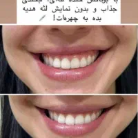 تزریق ژل و بوتاکس تضمینی|خدمات آرایشگری و زیبایی|اهواز, نادری|دیوار