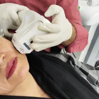 هایفو تراپی جوانسازی بدون درد و عوارض و جراحی