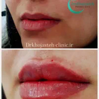 خدمات زیبایی برای زیباجویان عزیز|خدمات آرایشگری و زیبایی|چناران, |دیوار