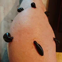 زالو درمانی و حجامت درطب سنتی با ۸ سال سابقه کار|خدمات آرایشگری و زیبایی|سبزوار, شرق کال میانی|دیوار