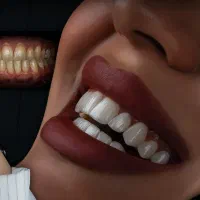 دندانپزشکی/کامپوزیت/لمینت/ایمپلنت|خدمات آرایشگری و زیبایی|مشهد, هفت تیر (حافظ)|دیوار