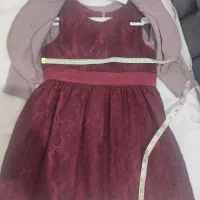 تعدادی پیراهن دخترانه شیک|کفش و لباس بچه|تهران, افسریه شمالی|دیوار