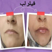 خدمات زیبایی جامع با بهترین کیفیت|خدمات آرایشگری و زیبایی|اصفهان, شاهزاده ابراهیم|دیوار