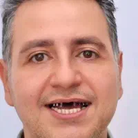 دندانپزشکی ایمپلنت کامپوزیت روکش لمینت‌ ارتودنسی|خدمات آرایشگری و زیبایی|تبریز, |دیوار