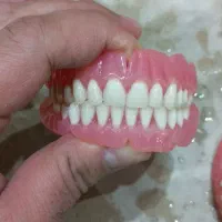 دندان مصنوعی|خدمات آرایشگری و زیبایی|قرچک, محمد آباد|دیوار