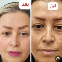 محصولات ضدلک|آرایشی، بهداشتی، درمانی|قم, آرامستان بهشت معصومه|دیوار