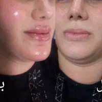 انجام خدمات زیبایی خانم و اقا