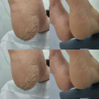 پدیکور پا|خدمات آرایشگری و زیبایی|اهواز, شهرک دانشگاه|دیوار