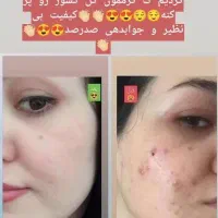 جوراب سیلیکونی برا ترک و خار پاشنه پا عالی|لباس|ارزوئیه, |دیوار