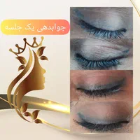 ریموو تتو با لیزر کیوسوئیچ و روشن سازی نواحی تیره|خدمات آرایشگری و زیبایی|قم, زنبیل آباد|دیوار