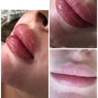 ژل و بوتاکس|خدمات آرایشگری و زیبایی|شیراز, دوکوهک|دیوار