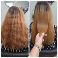 پرتیین تراپی