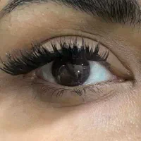 کاشت مژه