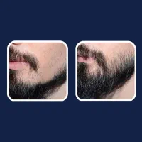 ریش ۲|آرایشی، بهداشتی، درمانی|برازجان, |دیوار
