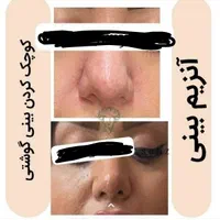 انزیم بینی|خدمات آرایشگری و زیبایی|الشتر, |دیوار