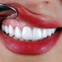 جشنواره دندانپزشکی دیجیتال با تخفیفات ویژه|خدمات آرایشگری و زیبایی|کرج, اصفهانی‌ها|دیوار