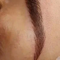 مدل برای میکرو وفیبروز