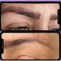 ریموو تاتو، پاک کردن تتو تخصصی کرج، البرز|خدمات آرایشگری و زیبایی|کرج, عظیمیه|دیوار