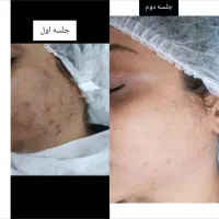 مرکز تخصصی فیشیال و آبرسانی و پاکسازی پوست|خدمات آرایشگری و زیبایی|اندیشه, اندیشه فاز ۱|دیوار