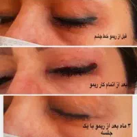 ریموو و آموزش تخصصی تاتو صورت ابرو تک جلسه ای|خدمات آرایشگری و زیبایی|قم, زنبیل آباد|دیوار