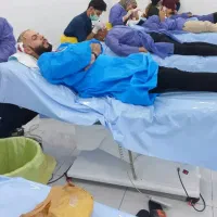 کاشت تخصصی مو و ابرو با اقساط بلندمدت در اهواز