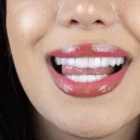 ایمپلنت  کره‌ای‌ 7900 /سوئیسی‌/ضمانت/کیفیت|خدمات آرایشگری و زیبایی|کرج, عظیمیه|دیوار