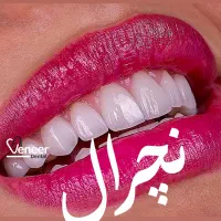 دندانیزشکی کامپوریت لمینت اینیلنت|خدمات آرایشگری و زیبایی|تهران, قیطریه|دیوار
