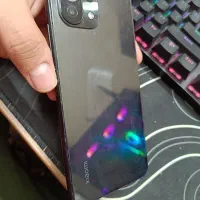 Mi 11 lite (همه وسایل به غیر از هارد و سی پی یو)