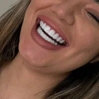 کامپوزیت دندان با تخفیف ویژه و مواد درجه یک