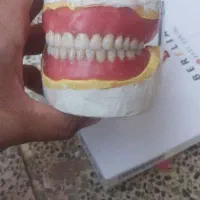 ساخت انواع دندان مصنوعی متحرک
